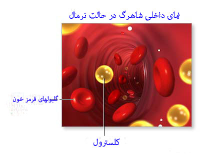 عوارض کلسترول پایین , تغذیه لازم برای بالا بردن hdl , علت پایین بودنhdl 