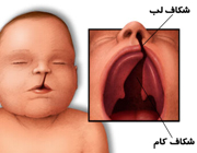 گریه نوزاد,گریه نوزاد در خواب,گریه نوزادان,بیماری های کودکان ,بیماری نوزاد ,بیماری کودک