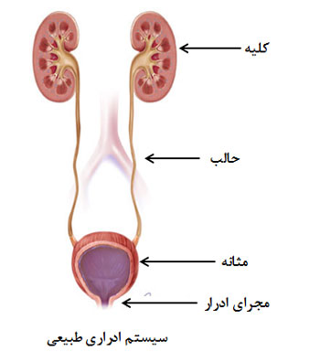 چطور متوجه بشیم بچه برگشت ادرار به کلیه دارد 