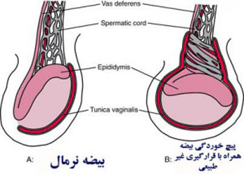 درد بیضه ناشی از تحریک جنسی 