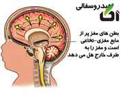 عایم اب اودن مغز 