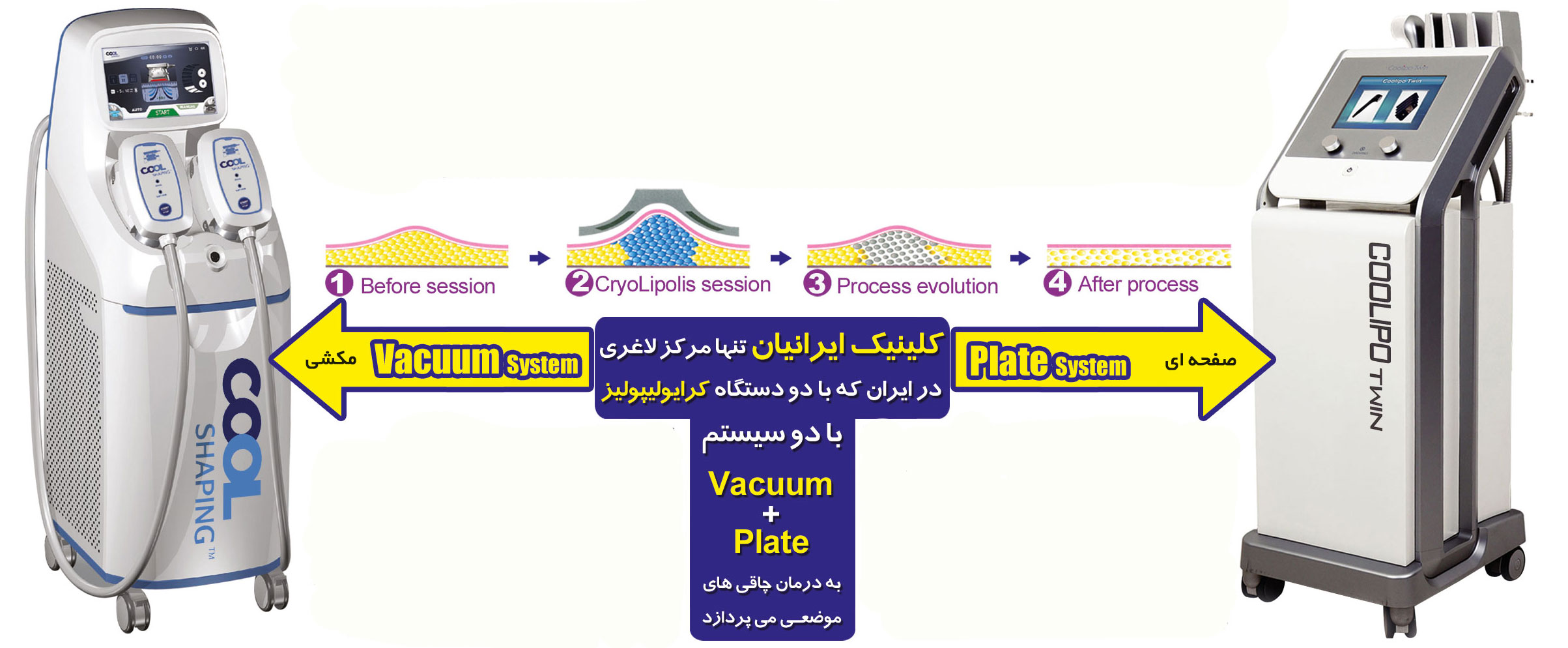 ,درمان لاغری موضعی , جدیدترین روش بدون جراحی,مقالات پزشکی و بهداشتی،توصیه های پزشکی ، بهداشت