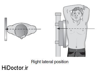 رادیولوژی ریه سالم , تفسیرعکس رادیولوژی قفسه سینه 