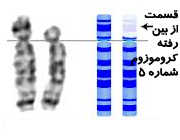 گریه نوزاد,گریه نوزاد در خواب,گریه نوزادان,بیماری های کودکان ,بیماری نوزاد ,بیماری کودک