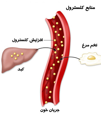 کم بودن کلسترول خون , hdlکلسترول کم , کلسترول پایین 